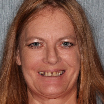 before-after-lori-1